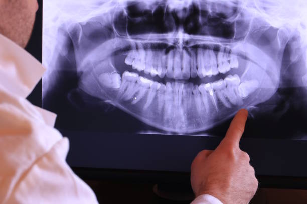 Best Emergency Root Canal Treatment in Pinch, WV