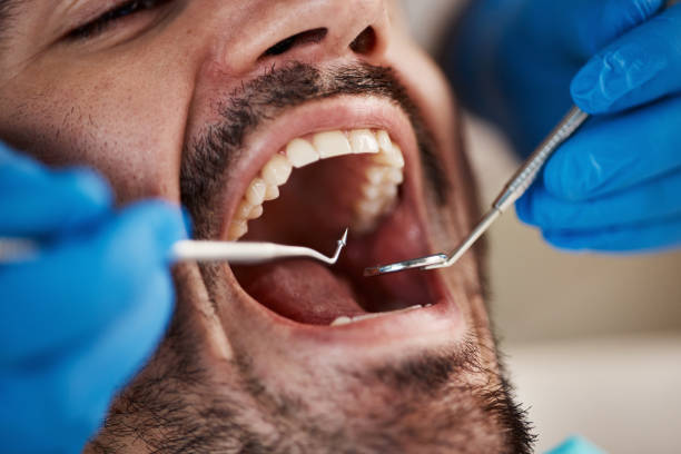 Best Emergency Dental Services for Seniors in Pinch, WV